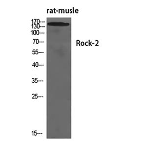 Rock-2兔多抗,Rock-2 Rabbit Polyclonal Antibody