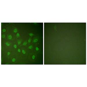 Rpb1兔多抗,Rpb1 Rabbit Polyclonal Antibody