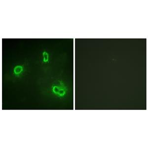 Rsk-1兔多抗,Rsk-1 Rabbit Polyclonal Antibody