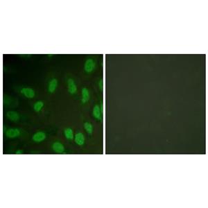 RUNX1兔多抗,RUNX1 Rabbit Polyclonal Antibody