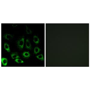 S2P兔多抗,S2P Rabbit Polyclonal Antibody