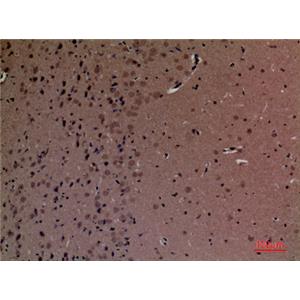 SHIP-2兔多抗,SHIP-2 Rabbit Polyclonal Antibody