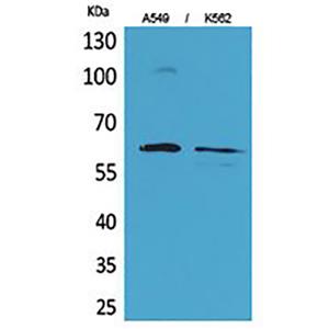 Smad1兔多抗,Smad1 Rabbit Polyclonal Antibody