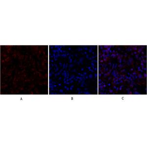 Smad4兔多抗,Smad4 Rabbit Polyclonal Antibody