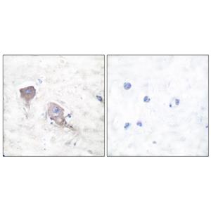 SNAP 25兔多抗,SNAP 25 Rabbit Polyclonal Antibody