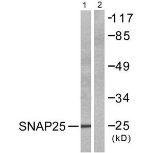SNAP 25兔多抗,SNAP 25 Rabbit Polyclonal Antibody