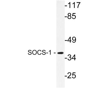 SOCS-1兔多抗,SOCS-1 Rabbit Polyclonal Antibody