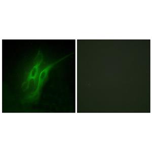 SR-4兔多抗,SR-4 Rabbit Polyclonal Antibody