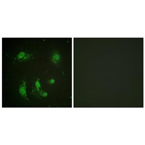 Survivin兔多抗,Survivin Rabbit Polyclonal Antibody