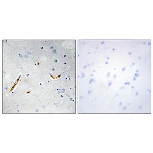 TCF-3兔多抗,TCF-3 Rabbit Polyclonal Antibody