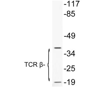 TCR β兔多抗,TCR β Rabbit Polyclonal Antibody