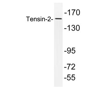 Tensin-2兔多抗,Tensin-2 Rabbit Polyclonal Antibody