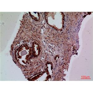 TF兔多抗,TF Rabbit Polyclonal Antibody