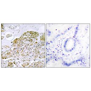 TFEB兔多抗,TFEB Rabbit Polyclonal Antibody