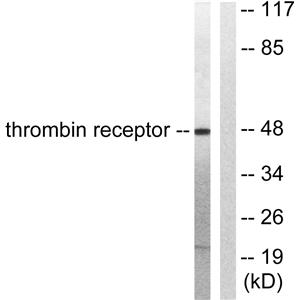 Thrombin R兔多抗,Thrombin R Rabbit Polyclonal Antibody