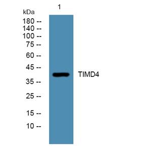TIMD4兔多抗,TIMD4 Rabbit Polyclonal Antibody