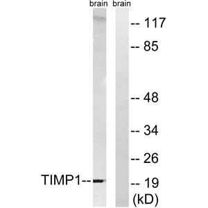 TIMP-1兔多抗,TIMP-1 Rabbit Polyclonal Antibody