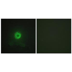 TNF-R2兔多抗,TNF-R2 Rabbit Polyclonal Antibody