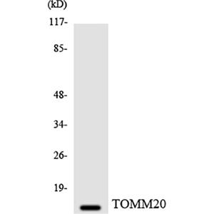 Tom20兔多抗,Tom20 Rabbit Polyclonal Antibody