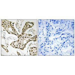 Topo IIα兔多抗,Topo IIα Rabbit Polyclonal Antibody