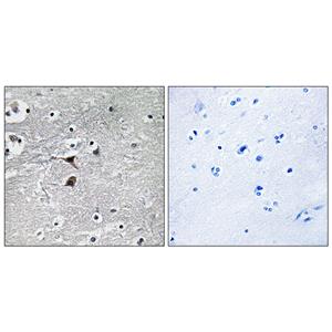 TPH1兔多抗,TPH1 Rabbit Polyclonal Antibody