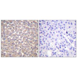 TRADD兔多抗,TRADD Rabbit Polyclonal Antibody