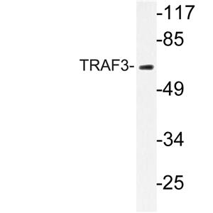 TRAF3兔多抗,TRAF3 Rabbit Polyclonal Antibody