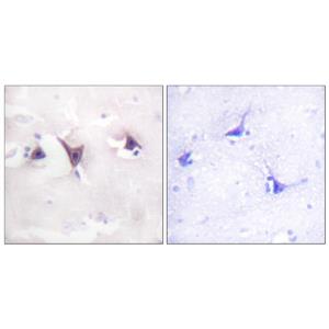Trk B兔多抗,Trk B Rabbit Polyclonal Antibody