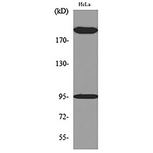 Trk C兔多抗,Trk C Rabbit Polyclonal Antibody