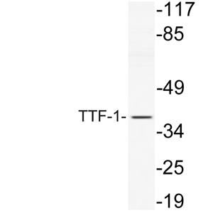TTF-1兔多抗,TTF-1 Rabbit Polyclonal Antibody