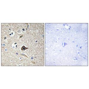 TWEAK兔多抗,TWEAK Rabbit Polyclonal Antibody