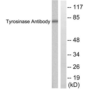 TYR兔多抗,TYR Rabbit Polyclonal Antibody