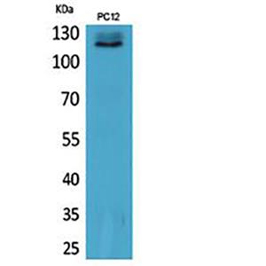 UBA1兔多抗,UBA1 Rabbit Polyclonal Antibody