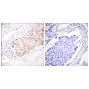 UBR5兔多抗,UBR5 Rabbit Polyclonal Antibody