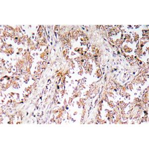 UCP2兔多抗,UCP2 Rabbit Polyclonal Antibody