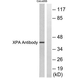 XPA兔多抗,XPA Rabbit Polyclonal Antibody