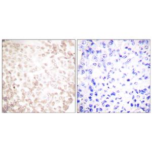 XRCC1兔多抗,XRCC1 Rabbit Polyclonal Antibody