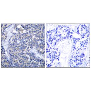 ZAP-70兔多抗,ZAP-70 Rabbit Polyclonal Antibody