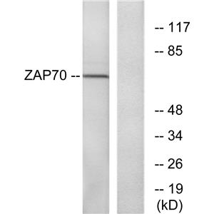 ZAP-70兔多抗,ZAP-70 Rabbit Polyclonal Antibody