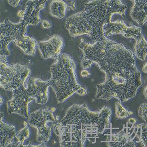 SW1463（人直肠腺癌细胞）YB-72055HC,SW1463