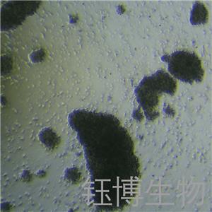 MJ（人原发性皮肤 T 细胞非霍奇金淋巴瘤）YB-72060HC