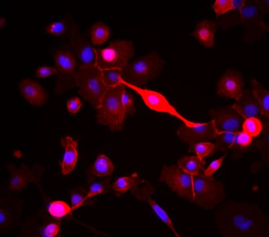 人表皮黑色素细胞,Human epidermal melanocytes