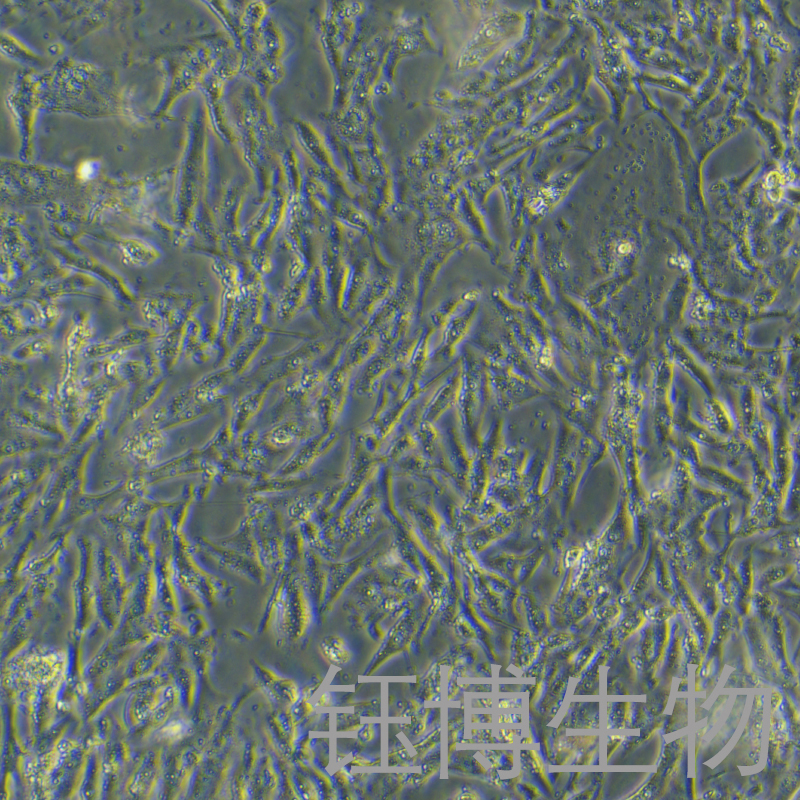 SW900（人肺鳞癌细胞grade IV）YB-72074HC,SW900