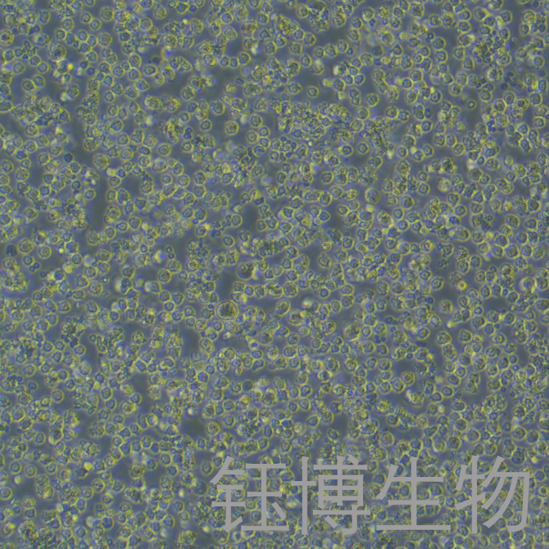 OCI-LY1（人B细胞淋巴瘤）YB-72088HC,OCI-LY1