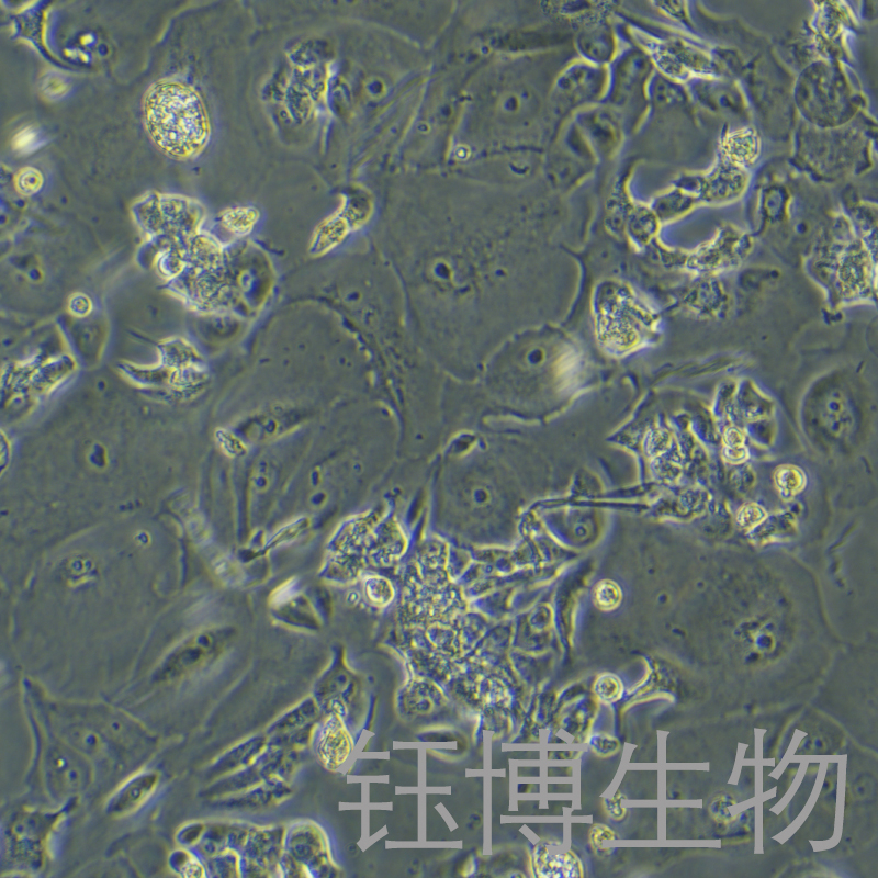 CAMA1（人乳腺腺癌细胞）YB-72127HC,CAMA1