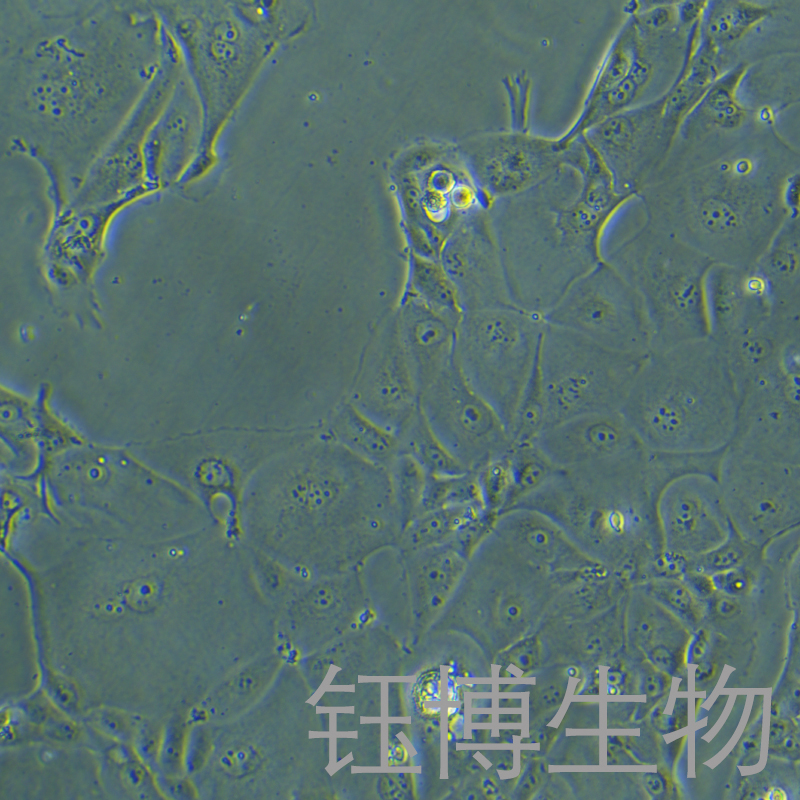 SU.86.86（人胰腺导管癌细胞）YB-72129HC,SU.86.86