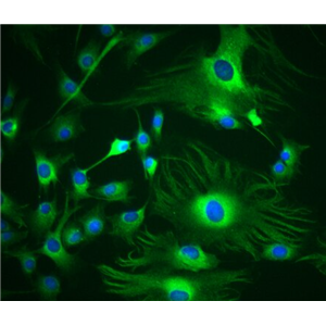 人肺血管周细胞,Human pulmonary perivascular cells