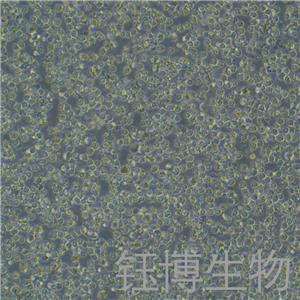 OCI-LY1（人B细胞淋巴瘤）YB-72088HC