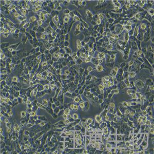 NCI-H1915（人非小细胞肺癌细胞）YB-72108HC,NCI-H1915