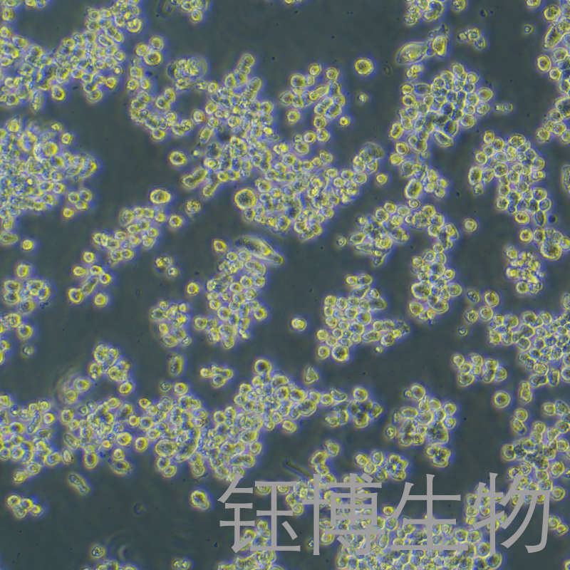 KMS11（人骨髓瘤细胞）YB-72137HC,KMS11